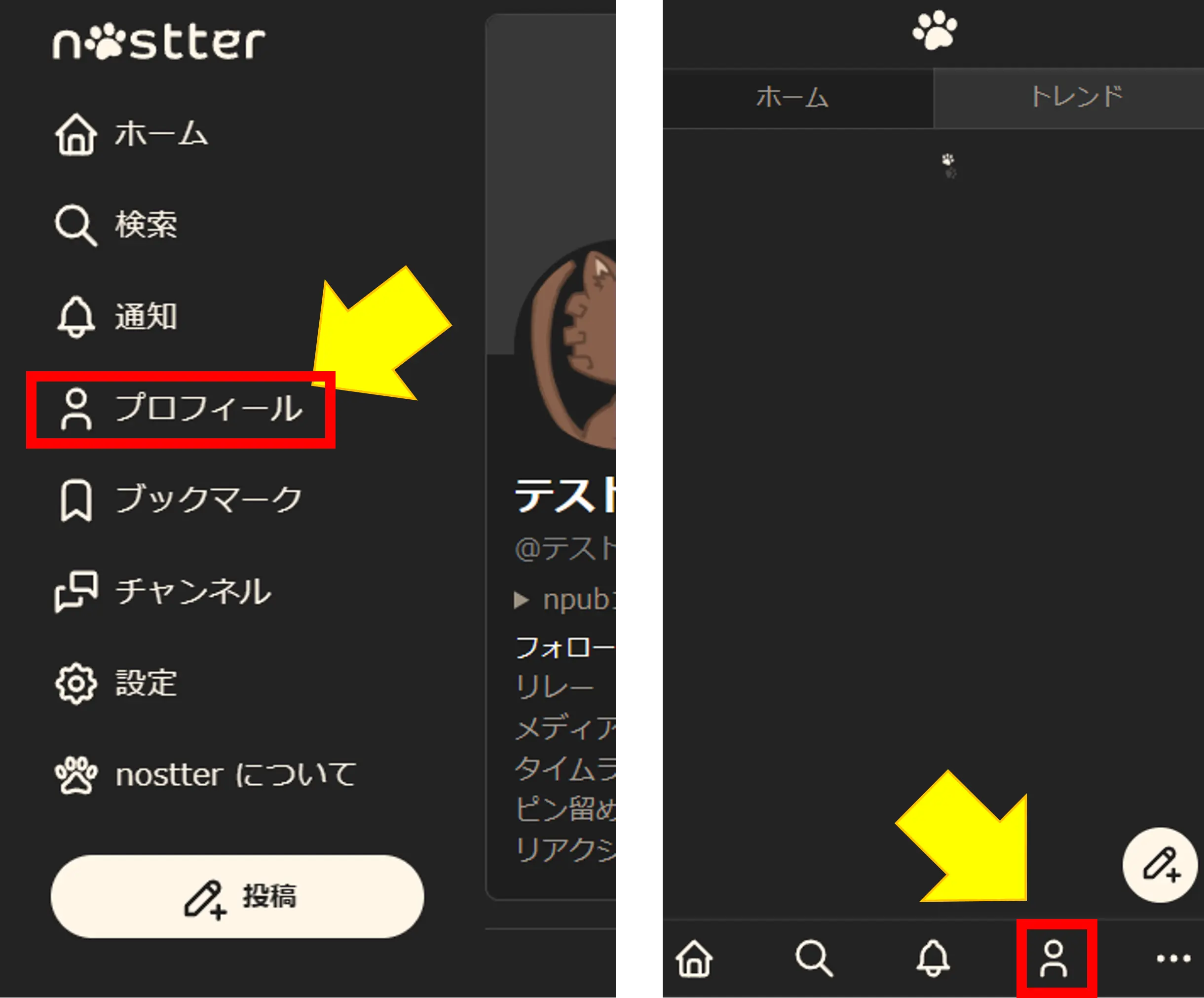 プロフィールボタン